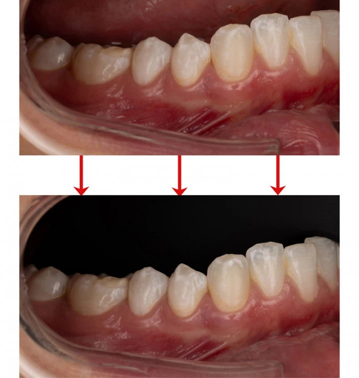 Black Silicone Flexible Contrastors thumbnail 3