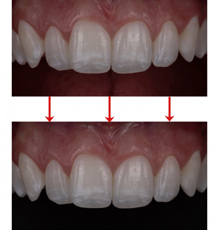 Black Silicone Flexible Contrastors thumbnail 4